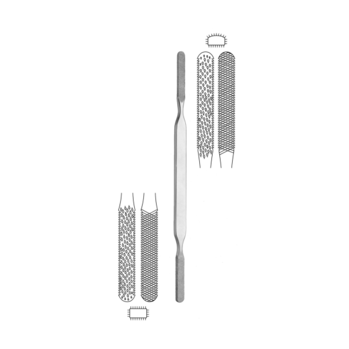 FOMON BONE AND NASAL RAS